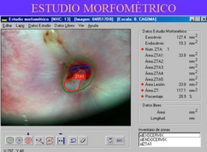 ESTUDIO MORFOMÉTRICO